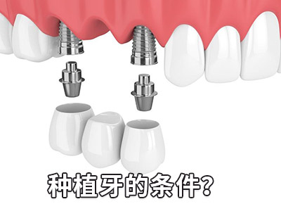 天津中诺口腔医院4颗半口种植牙要多少钱