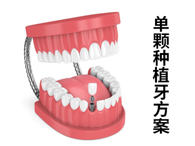 天津中诺口腔医院老人缺牙种植牙多少钱