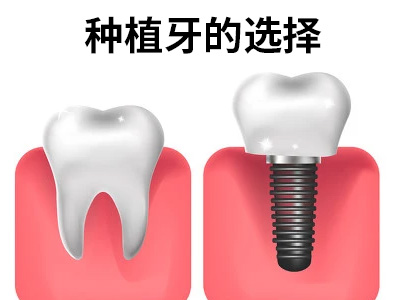 天津老年人种植牙满口多少钱-天津老人镶牙满口多少钱