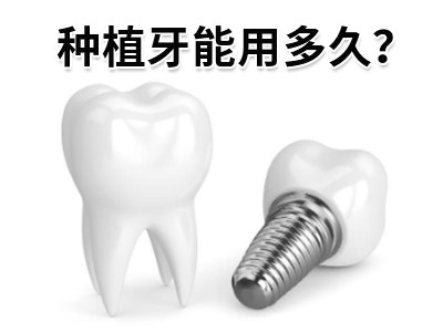 天津全口种植牙一般种几颗牙需多少价格