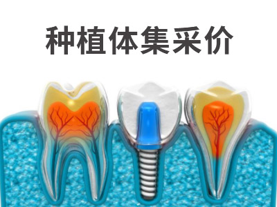 天津满口牙种植价格大概要多少钱