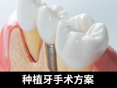 天津老年人种植牙一次可种几颗-天津种牙种几颗合适