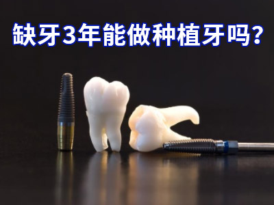 天津全口牙种植牙的价格是多少