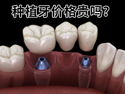 天津半口缺牙种植费用需要多少钱