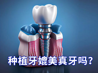 天津老年人种植牙修复怎么样要多少钱