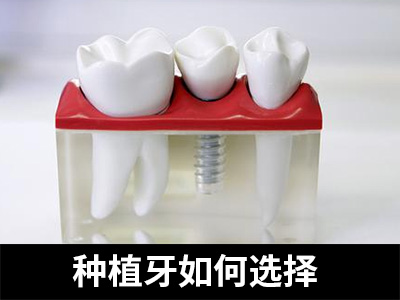 天津50多岁牙齿全口种植牙-天津老人能做全口种植牙吗