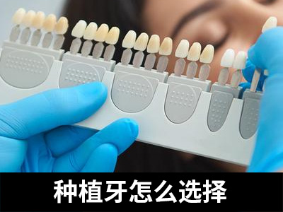 天津哪家口腔医院人工种植牙好?(关注）天津种植牙医院排名