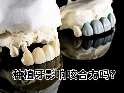 2023种植牙价格表-天津种植半口牙大概需要费用
