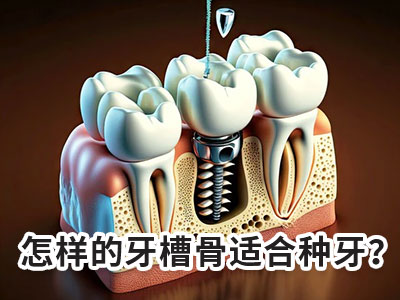 天津哪个牙科医院可以种植牙齿需多少钱