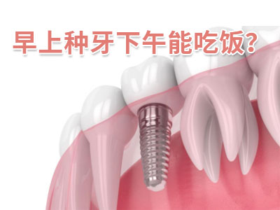 天津老人种植半口牙的价格需要多少钱