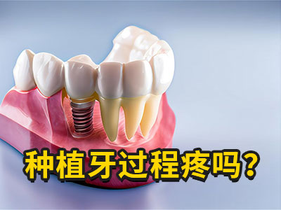 天津老人种植半口牙需要多少钱