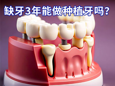 天津满口无牙需种植几颗牙和价格需多少钱