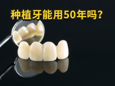 天津allon6全口种植牙怎么样大概多少价格