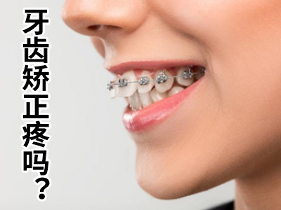 天津龅牙矫正牙齿价格-天津牙齿畸形矫正价格