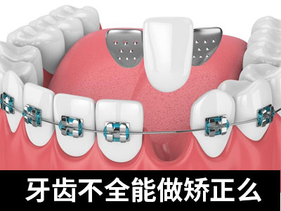 天津地包天五十岁能矫正牙齿吗需要多少钱