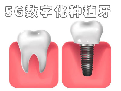 天津即刻负重的八颗种植牙费用需要多少钱