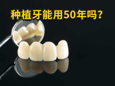 天津缺了四颗大牙选种植牙好吗需要多少钱