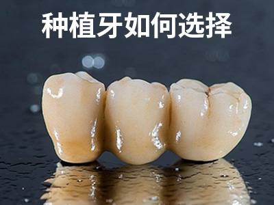 天津缺半口需要种植几颗牙?天津种植全口牙齿多少颗