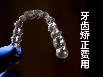 天津12岁儿童隐形牙齿矫正费用需要多少钱