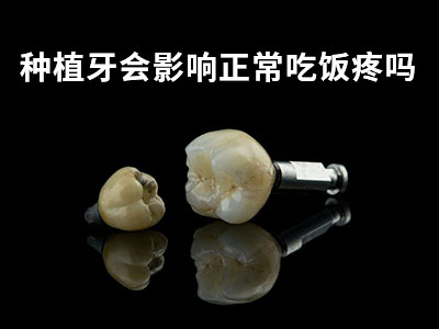 天津镶一颗全瓷牙牙大概需要多少钱呢
