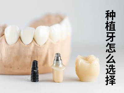天津老年人种植满口牙多少钱?天津种植牙价钱表