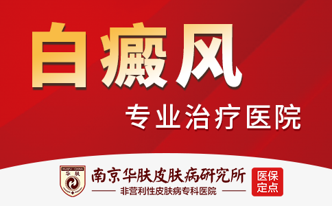 南京白癜风哪里治
