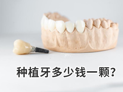 天津种植一颗牙全部费用多少钱种植牙价格表