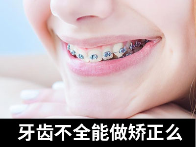 天津2023年牙齿矫正价格是多少呢价格表