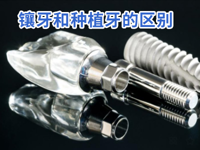 天津半口牙种植半固定好吗价格要多钱