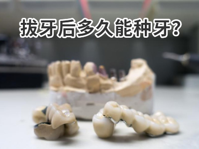 天津3d种植牙一般全口牙种植几个需要多少钱