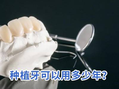 天津老年人做全口种植牙要多少钱费用表