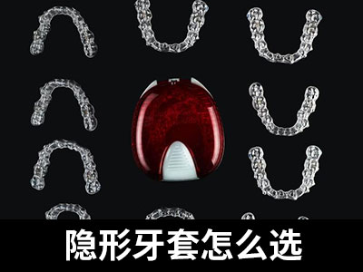 天津陶瓷自锁托槽牙齿矫正价格大概要多少钱