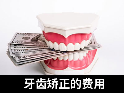 天津做一个自锁托槽牙齿矫正的费用是多钱