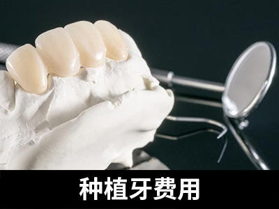天津全口种植牙的牙床植骨费用-天津一颗种植牙费用