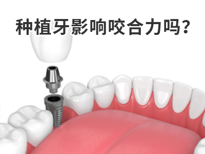 天津3d导板精准种植牙怎么样要多少钱