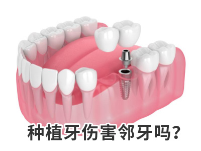 天津数字化3d即刻种植牙是什么需多少钱