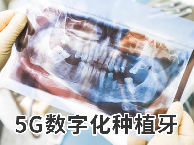 天津3d数字化导板种植牙大约需要多少费用