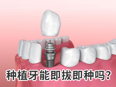 天津二氧化锆全瓷牙多少钱要多少费用