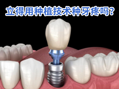 天津全口种植牙费用一般是多少价格表