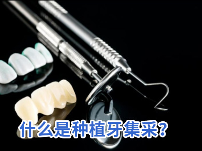 天津半口缺失牙种植几颗牙需要多少价格