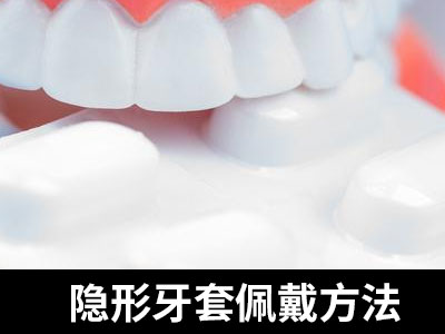 天津2023年牙齿矫正价格是多少呢要多钱