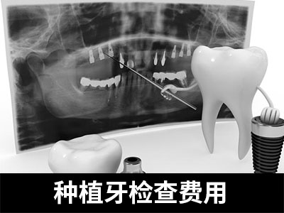 天津67岁种植一颗牙齿费用-天津种植牙齿价格