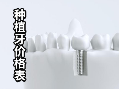 天津半口种植义齿即刻修复需要多少价格