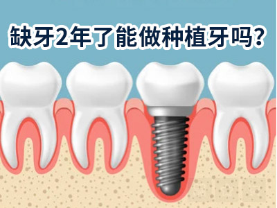 天津种植牙一次拔4颗牙好吗大概要多少钱