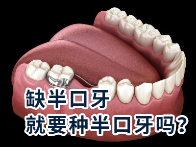 天津口腔医院种植牙收费多少一颗需要多少钱