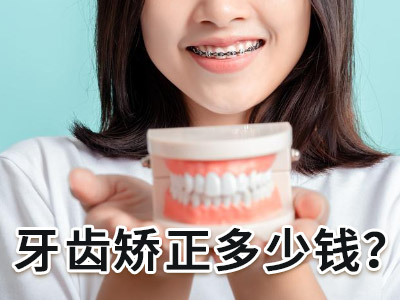 天津儿童牙齿矫正的医院排名前十矫正多少钱